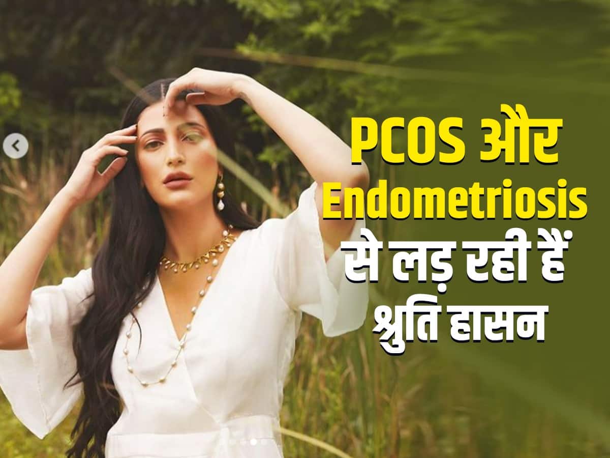 PCOS और Endometriosis से लड़ रही हैं श्रुति हासन, एक्सरसाइज की मदद से लक्षणों को कर रही हैं कंट्रोल